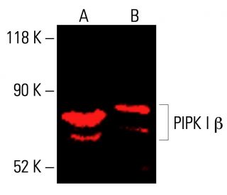 PIPK I &beta; Antibody (F-4) - Western Blotting - Image 415799 
