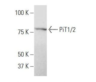 PiT1/2 Antibody (SY-12) - Western Blotting - Image 34655SAM Transcription Activation: SAM system utilizing dCas9-VP64, MS2-P65-HSF1, and sgRNA for precise gene transcription activation.