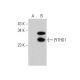 PITHD1 Antibody (A-10) - Western Blotting - Image 346553