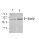 PIWIL4 Antibody (10G9B11) - Western Blotting - Image 358293 