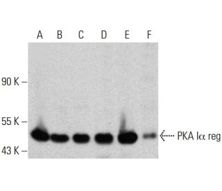 PKA I&alpha; reg Antibody (20) - Western Blotting - Image 385759Each CRISPR/Cas9 Knockout (KO) Plasmid product consists of a pool of 3 plasmids designed to ensure identification and cleavage of a specific gene for maximum knockout efficiency. Each plasmid encodes a unique 20 nt sequence derived from the GeCKO (v2) library. 