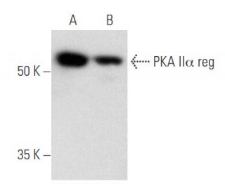 PKA II&alpha; reg Antibody (H-12) - Western Blotting - Image 356541 