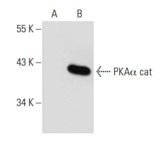 PKA&alpha;/&beta; cat Antibody (3C1) - Western Blotting - Image 38695