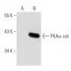 PKAα/β cat Antibody (3C1) - Western Blotting - Image 38695