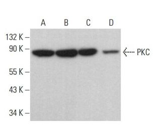 PKC Antibody (MC5) - Western Blotting - Image 380254 