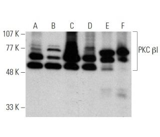 PKC beta 1 Antibody (E-3) - Western Blotting - Image 370728 