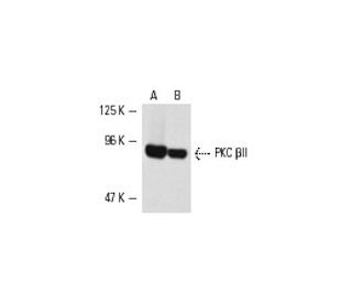 PKC beta 2 Antibody (F-7) - Western Blotting - Image 2002 