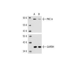 PKC &delta; siRNA (h): sc-36253. Western blot analysis of PKC &delta; expression in non-transfected control (A) and PKC &d 