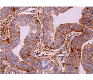 PKC lambda/iota Antibody (E-7) - Immunohistochemistry - Image 369606 
