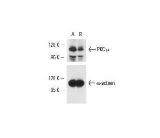 PKC &mu; siRNA (h): sc-36245. Western blot analysis of PKC &mu; expression in non-transfected control (A) and PKC &mu; siR 