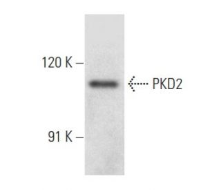 PKD2 Antibody (H-6) - Western Blotting - Image 357335