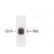 PKN Antibody (49) - Western Blotting - Image 60412