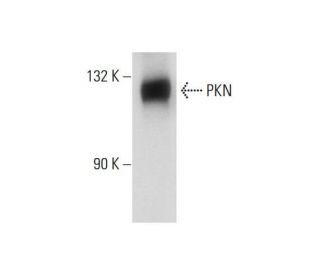 PKN Antibody (49) - Western Blotting - Image 129435 