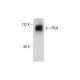 PKN Antibody (49) - Western Blotting - Image 129435 