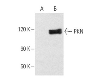 PKN Antibody (A-8) - Western Blotting - Image 1907