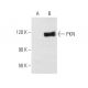 PKN Antibody (A-8) - Western Blotting - Image 1907