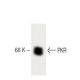 PKR Antibody (13) - Western Blotting - Image 60413