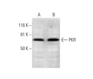 PKR Antibody (A-12) - Western Blotting - Image 291933 