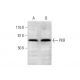 PKR Antibody (A-12) - Western Blotting - Image 291933 