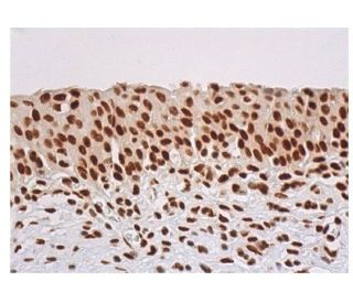 PKR Antibody (H-12) - Immunohistochemistry - Image 352307 