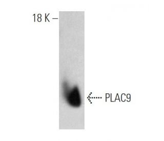 PLAC9 Antibody (F7) - Western Blotting - Image 374565