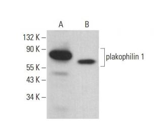plakophilin 1 Antibody (10B2) - Western Blotting - Image 382074 