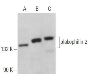plakophilin 2 Antibody (C-1) - Western Blotting - Image 359060 
