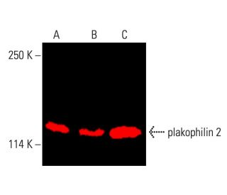 plakophilin 2 Antibody (C-1) - Western Blotting - Image 403887