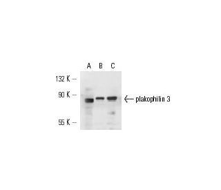 plakophilin 3 Antibody (12B11F8) - Western Blotting - Image 14975 