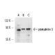 plakophilin 3 Antibody (12B11F8) - Western Blotting - Image 14975 