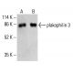 plakophilin 3 Antibody (12B11F8) - Western Blotting - Image 413224