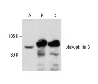 plakophilin 3 Antibody (4A82) - Western Blotting - Image 58451 