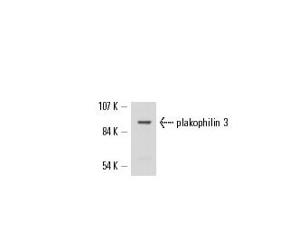 plakophilin 3 Antibody (E612B11F8) - Western Blotting - Image 17295 