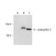 plakophilin 3 Antibody (E612B11F8) - Western Blotting - Image 58449