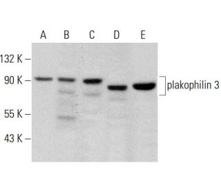 plakophilin 3 Antibody (H-8) - Western Blotting - Image 364844 