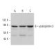 plakophilin 3 Antibody (H-8) - Western Blotting - Image 379501
