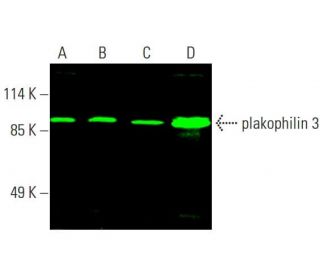 plakophilin 3 Antibody (E-10) - Western Blotting - Image 387620