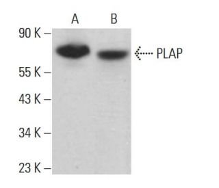 PLAP Antibody (HD 11F7) - Western Blotting - Image 380858 