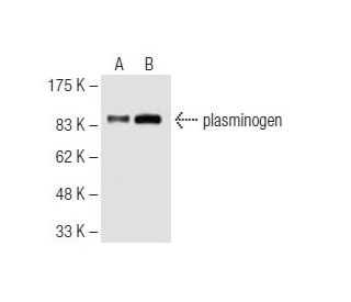 plasminogen Antibody (10A1) - Western Blotting - Image 62797