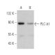 PLC δ1 Antibody (D-10) - Western Blotting - Image 360644