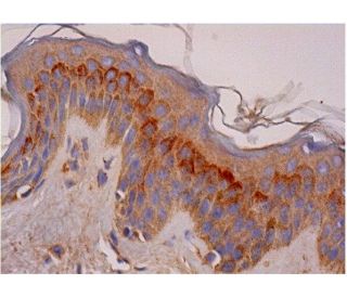 PLEKHA4 Antibody (H-1) - Immunohistochemistry - Image 286316 