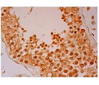 PLEKHM3 Antibody (A-2) - Immunohistochemistry - Image 304841 