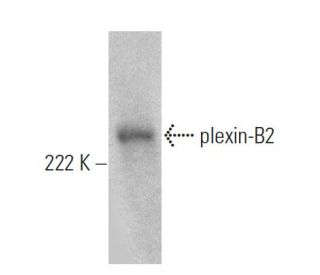plexin-B2 Antibody (H-12) - Western Blotting - Image 359984 