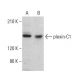 plexin-C1 Antibody (B-8) - Western Blotting - Image 382360 