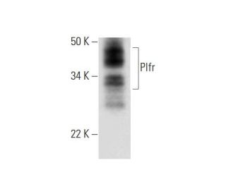 Plfr Antibody (F-8) - Western Blotting - Image 294467SAM Transcription Activation: SAM system utilizing dCas9-VP64, MS2-P65-HSF1, and sgRNA for precise gene transcription activation.