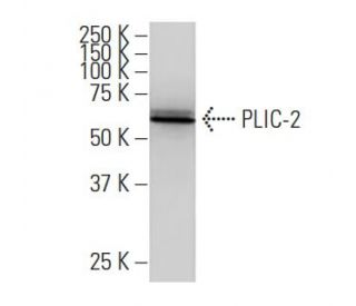 PLIC-2 Antibody (QR-2) - Western Blotting - Image 33983The Double Nickase Plasmid features a U6 promoter for sgRNA expression, a 20 nt targeting sequence, and a gRNA scaffold to guide Cas9n. It includes a CBh promoter for Cas9n (D10A) and puromycin resistance, GFP for transfection verification, and nuclear localization signals (NLS). The 2A peptide allows co-expression of Cas9n and Puro from a single promoter, enabling precise genome editing with reduced off-target effects.