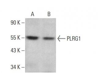PLRG1 Antibody (E-12) - Western Blotting - Image 376429 