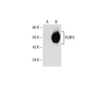 PLRP2 Antibody (D-1) - Western Blotting - Image 154682