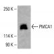 PMCA1-Antikörper (F-10): sc-398413. Western Blot Analyse der PMCA1 Expression in HeLa-Gesamtzelllysaten. Verwendetes Nachweisreagenz: m-IgG Fc BP-HRP: sc-525409. PMCA1 Antibody (F-10) - Western Blotting - Image 415443