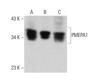 PMEPA1 Antibody (2A12) - Western Blotting - Image 384268 